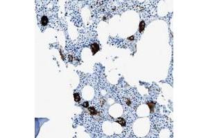 Immunohistochemical staining of human bone marrow with SLC22A15 polyclonal antibody  shows strong cytoplasmic positivity in megakaryocytes. (SLC22A15 抗体)
