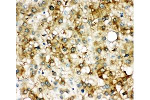 Immunohistochemistry (IHC) image for anti-serpin Peptidase Inhibitor, Clade A (Alpha-1 Antiproteinase, Antitrypsin), Member 3 (SERPINA3) (AA 218-232), (Middle Region) antibody (ABIN3044487)