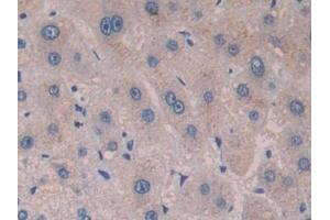Immunohistochemistry (IHC) image for anti-Cross-Linked C-Telopeptides of Type I Collagen (CTX-I) antibody (ABIN7427822)