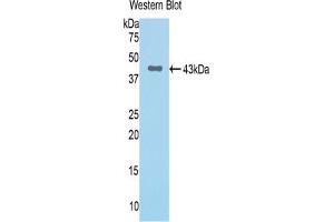 Western blot analysis of the recombinant protein. (Complement Factor B 抗体  (AA 34-159))