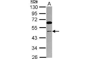 Western Blotting (WB) image for anti-Thyroid Hormone Receptor Interactor 13 (TRIP13) (AA 32-315) antibody (ABIN1501509) (TRIP13 抗体  (AA 32-315))