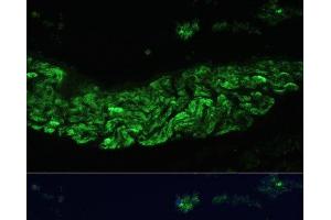 Immunofluorescence analysis of Rat lung using ALOX12 Polyclonal Antibody at dilution of 1:100 (40x lens). (ALOX12 抗体)