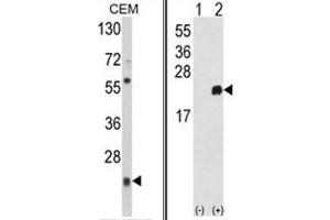 (LEFT) Western blot analysis of PRDX1 Antibody (Center) in CEM cell line lysates (35ug/lane). (Peroxiredoxin 1 抗体  (Middle Region))