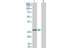 Western Blot analysis of SNAP25 expression in transfected 293T cell line by SNAP25 monoclonal antibody (M01), clone 4A3. (SNAP25 抗体  (AA 31-130))