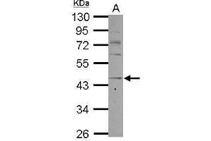 WB Image Sample (30 ug of whole cell lysate) A: K562 10% SDS PAGE antibody diluted at 1:1000 (CCR8 抗体  (C-Term))