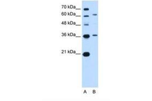 ZSCAN12 antibody  (AA 142-191)