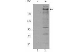 Western Blotting (WB) image for anti-Ataxia Telangiectasia Mutated (ATM) (phosphorylated) antibody (ABIN2666314) (ATM 抗体  (phosphorylated))