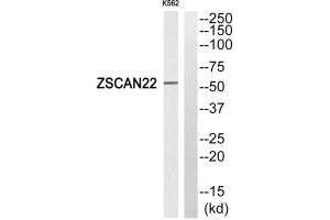 Western blot analysis of extracts from K562 cells, using ZSCAN22 antibody.