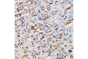 Immunohistochemistry of paraffin-embedded rat brain using MLC3A antibody (ABIN6134219, ABIN6143466, ABIN6143468 and ABIN6215215) at dilution of 1:100 (40x lens). (MAP1LC3A 抗体  (AA 1-100))