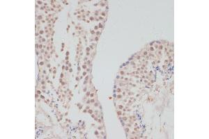 Immunohistochemistry of paraffin-embedded mouse testis using Cyclin G1 antibody (ABIN6127734, ABIN6138095, ABIN6138096 and ABIN6220906) at dilution of 1:100 (40x lens). (Cyclin G1 抗体  (C-Term))