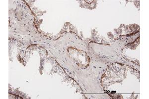Immunoperoxidase of purified MaxPab antibody to KRT15 on formalin-fixed paraffin-embedded human prostate. (KRT15 抗体  (AA 1-456))