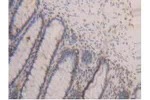 IHC-P analysis of Human Rectum Tissue, with DAB staining. (PCNA 抗体  (AA 6-261))