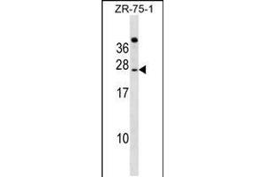Western blot analysis in ZR-75-1 cell line lysates (35ug/lane). (IGSF6 抗体  (AA 69-97))