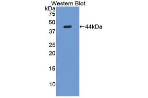 Detection of Recombinant LUM, Human using Polyclonal Antibody to Lumican (LUM) (LUM 抗体  (AA 19-338))