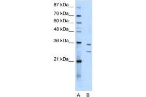 Western Blotting (WB) image for anti-Brix Domain Containing 5 (RPF1) antibody (ABIN2462306) (RPF1 抗体)