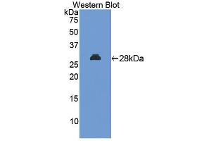Western blot analysis of the recombinant protein. (MAPKAP Kinase 2 抗体  (AA 117-337))