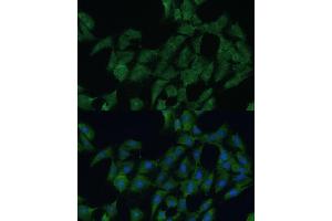 Immunofluorescence analysis of C6 cells using DDX3Y Polyclonal Antibody (ABIN6130260, ABIN6139496, ABIN6139497 and ABIN6215395) at dilution of 1:100 (40x lens). (DDX3Y 抗体  (AA 1-210))