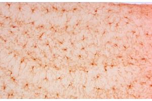 Immunohistochemistry (IHC) image for anti-Ionized Calcium-binding Adapter Molecule 1 (IBA1) (C-Term) antibody (ABIN2857032)