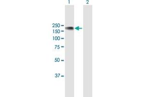 Western Blotting (WB) image for anti-Nuclear Factor of Activated T-Cells, Cytoplasmic, Calcineurin-Dependent 3 (NFATC3) (AA 1-1068) antibody (ABIN518311)