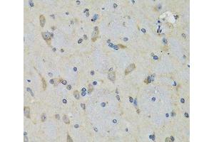Immunohistochemistry of paraffin-embedded Rat brain using RAE1 Polyclonal Antibody at dilution of 1:100 (40x lens). (RAE1 抗体)