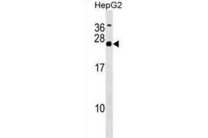 Western Blotting (WB) image for anti-MRG-Binding Protein (MRGBP) antibody (ABIN2999942) (MRGBP 抗体)