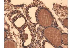 Immunohistochemistry (IHC) image for anti-Solute Carrier Family 5 (Sodium/iodide Cotransporter), Member 5 (SLC5A5) (AA 468-643) antibody (Atto 390) (ABIN2484447)