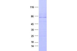 Validation with Western Blot