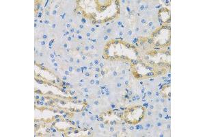 Immunohistochemistry of paraffin-embedded rat kidney using HS1BP3 antibody. (HS1BP3 抗体  (AA 1-200))