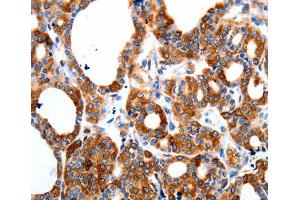 Immunohistochemistry (IHC) image for anti-Hyperpolarization Activated Cyclic Nucleotide-Gated Potassium Channel 1 (HCN1) antibody (ABIN3023439) (HCN1 抗体)