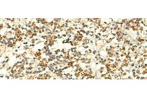 Immunohistochemistry of paraffin-embedded Human tonsil tissue using IFT27 Polyclonal Antibody at dilution of 1:50(x200) (RABL4 抗体)