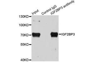 Immunoprecipitation analysis of 100ug extracts of HepG2 cells using 3ug IGF2BP3 antibody. (IGF2BP3 抗体)
