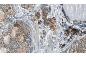 ABIN6278988 at 1/100 staining Human prostate tissue by IHC-P. (ALKBH7 抗体)