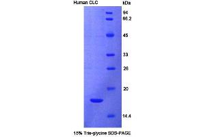 SDS-PAGE analysis of Human CLC Protein. (Galectin 10 蛋白)