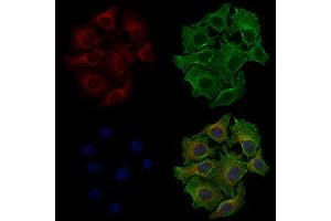 ABIN6258317 and ABIN6274726 staining HepG2 cells by IF/ICC.