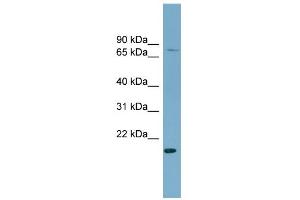 WB Suggested Anti-PDZRN4 Antibody Titration:  0. (PDZRN4 抗体  (N-Term))