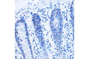 Immunohistochemistry of paraffin-embedded Human colon using Asymmetric DiMethyl-Histone H3-R8 Rabbit pAb (ABIN3017485, ABIN3017486, ABIN3017487 and ABIN6220109) at dilution of 1:100 (40x lens).