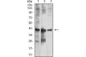 Western Blotting (WB) image for anti-Calponin 3, Acidic (CNN3) (AA 26-130) antibody (ABIN7193498)