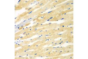 Immunohistochemistry of paraffin-embedded rat heart using PDE4DIP antibody at dilution of 1:100 (40x lens). (PDE4DIP 抗体)