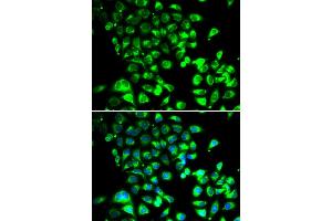 Immunofluorescence analysis of U2OS cells using SSBP1 antibody (ABIN5974202). (SSBP1 抗体)