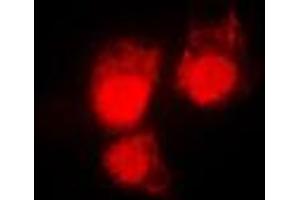 Immunofluorescent analysis of CDC2 (pT161) staining in HeLa cells. (CDK1 抗体  (pSer161))