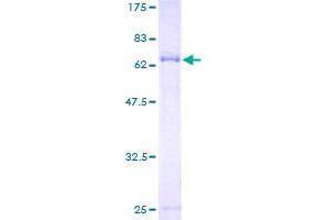 Anoctamin 10 Protein (ANO10) (AA 1-392) (GST tag)