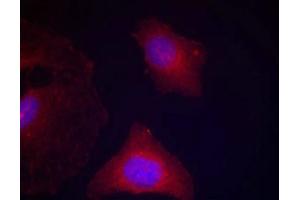 Immunofluorescence staining of methanol-fixed Hela cells using GSK3α/β(Phospho-Tyr279/216) Antibody.