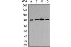 Western blot analysis of ABCB8 expression in Hela (A), HepG2 (B), mouse kidney (C), rat heart (D) whole cell lysates. (ABCB8 抗体)