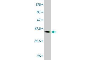 Western Blotting (WB) image for anti-Phosphatidylcholine Transfer Protein (PCTP) (AA 106-214) antibody (ABIN566189)