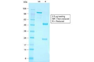 SDS-PAGE analysis of purified, BSA-free recombinant CD79a antibody (clone IGA/1790R) as confirmation of integrity and purity. (Recombinant CD79a 抗体  (AA 202-216))
