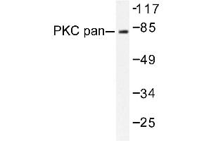 Image no. 1 for anti-Protein Kinase C, alpha (PKCa) antibody (ABIN272065) (PKC alpha 抗体)