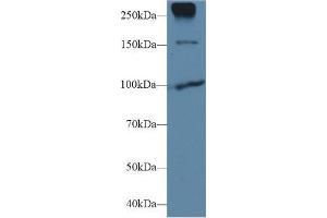 Western Blotting (WB) image for anti-Cadherin 1, Type 1, E-Cadherin (Epithelial) (CDH1) (AA 373-621) antibody (ABIN2901800)