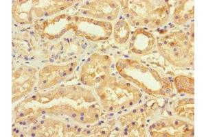 Immunohistochemistry of paraffin-embedded human kidney tissue using ABIN7175490 at dilution of 1:100 (SEC22A 抗体  (AA 10-187))