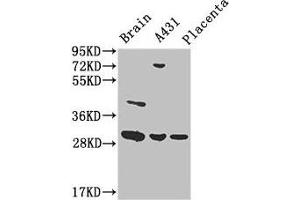 Western Blot Positive WB detected in: Mouse brain tissue, A431 whole cell lysate, Human placenta tissue All lanes: YWHAG antibody at 3. (14-3-3 gamma 抗体  (AA 113-194))