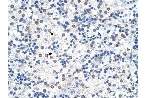 IKZF3 antibody was used for immunohistochemistry at a concentration of 4-8 ug/ml to stain Hepatocytes (arrows) in Human Liver. (IKZF3 抗体  (N-Term))